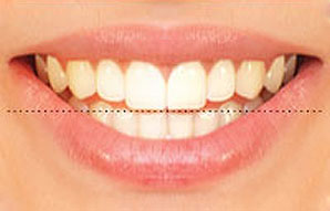 Horizontal Alignment