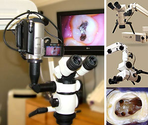 Dental Microscopes